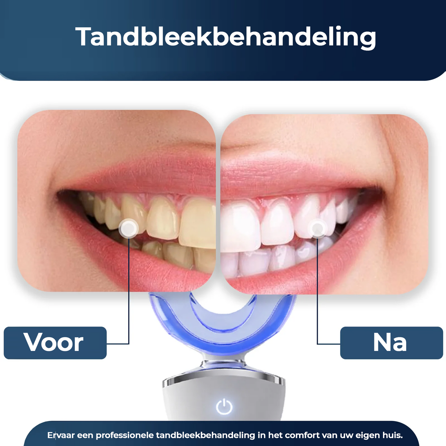 Milvora LumaNova™ | LED Tandenbleekset Voor Wittere Tanden Thuis