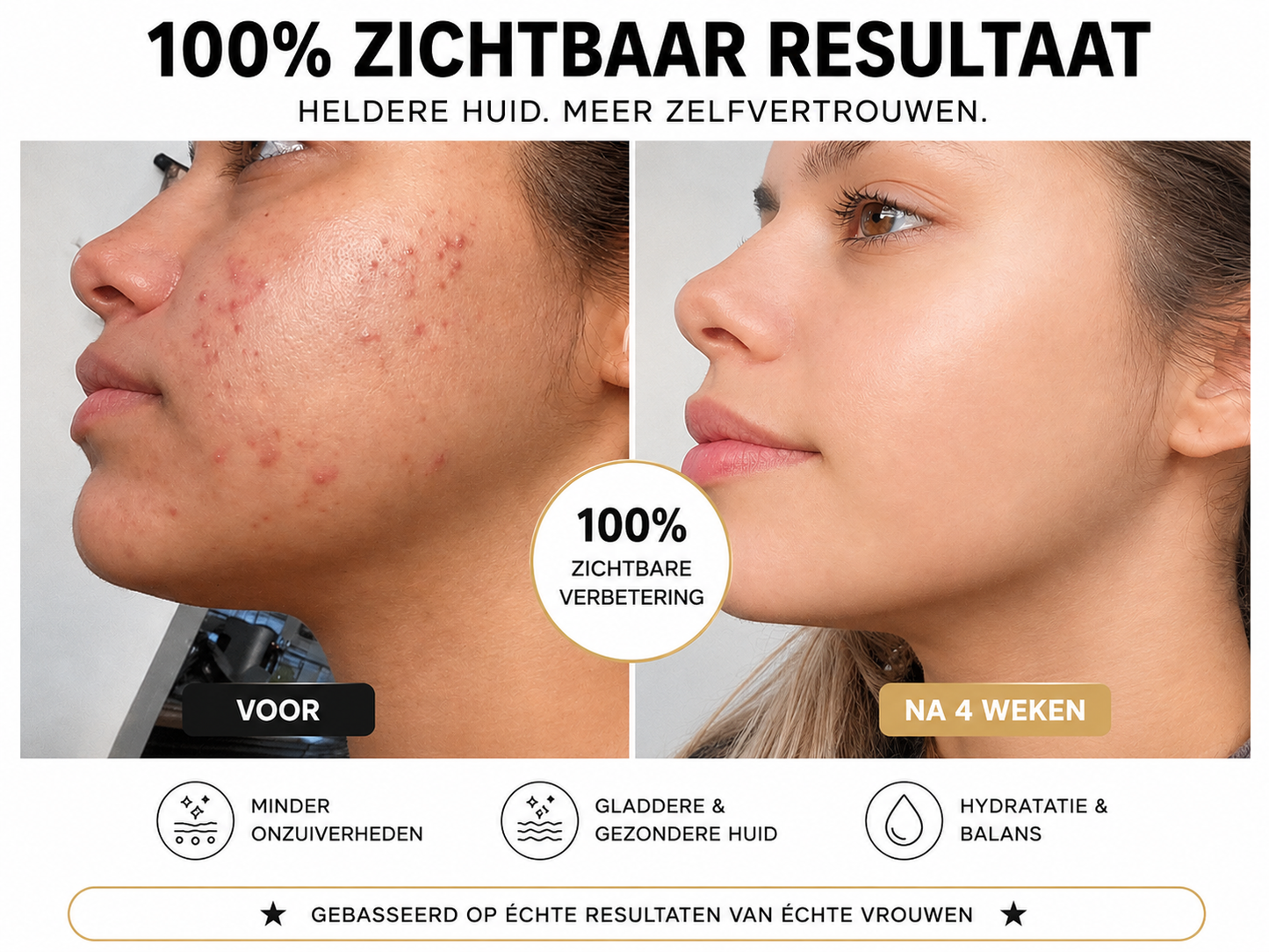 Milvora PuraVibe™ | Mee-eter Verwijderaar