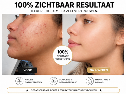 Milvora PuraVibe™ | Mee-eter Verwijderaar