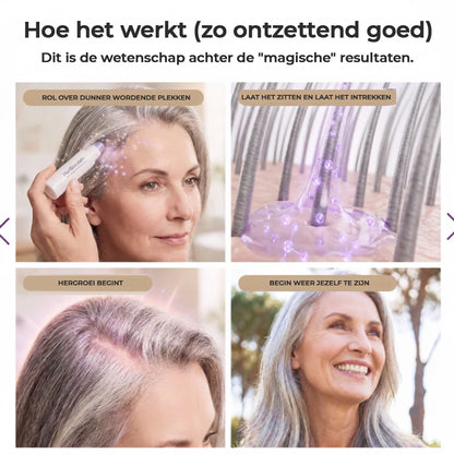 Milvora FolliForce Pro™ | HaarGroei Serum Voor Dikker & Voller Haar