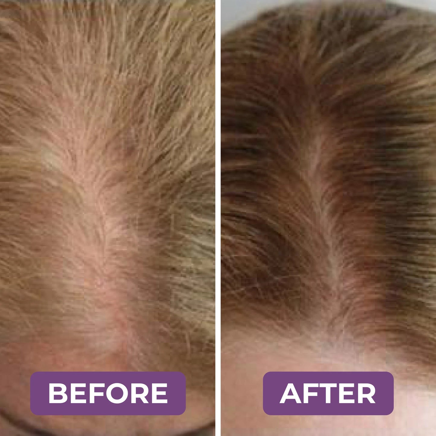 Milvora FolliForce Pro™ | HaarGroei Serum Voor Dikker & Voller Haar