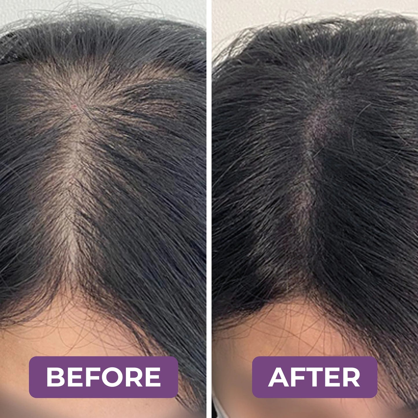 Milvora FolliForce Pro™ | HaarGroei Serum Voor Dikker & Voller Haar